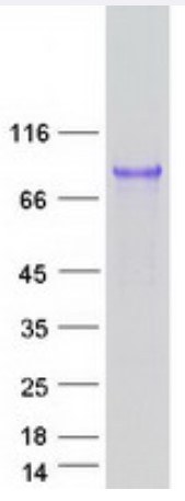 SDS PAGE (UMOD-001H).jpg